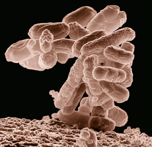 فاضلاب بهداشتی انسانی e.coli 300x289 300x289 - فاضلاب بهداشتی انسانی